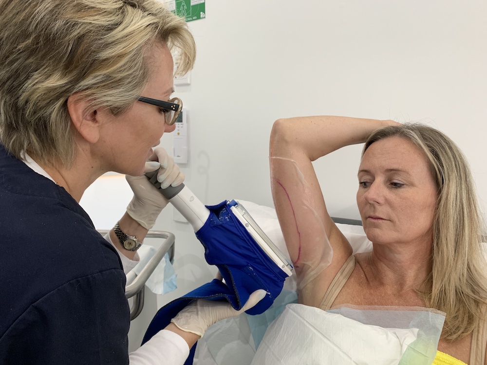 Treatment of CoolSculpting in Hannah Aesthetics
